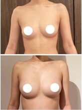 エスビューティー 三軒茶屋(S beauty)/バストケア・世田谷・痩身