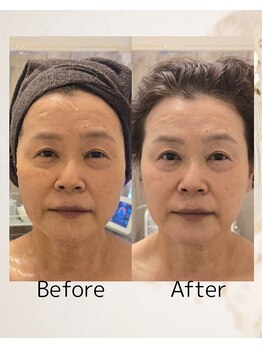 クリニカルスイート エーアール(Clinical sweet.ar)/若見え引き締めトータルケア