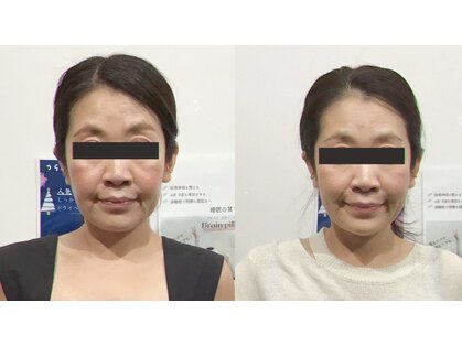 シンメトリー 麻布十番の写真