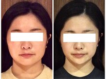 美容整体ウェリナ 名駅院/小顔矯正/骨盤矯正/美脚サロン