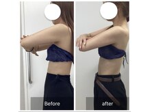 ダリア(Dahlia)/ボディマシン