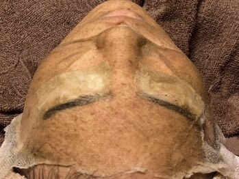 ミオン(Mion)の写真/【今治/韓国肌管理】敏感肌オーナーが何種類も試して選び抜いた本格ハーブピーリング★あらゆるお悩みに◎