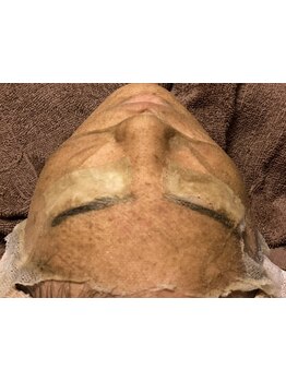 お肌をきれいにしたい