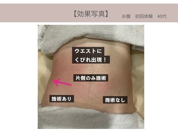 ミライ 福岡春日店(mirai)/なりたいを叶えるボディメイク