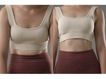 ローリエ/猫背・巻き肩が気になる