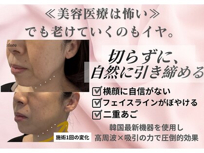 マウム(Maum)の写真