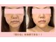 ベルメイク(BELLE MAKE)の写真
