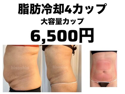 美痩身(bisoshin)の写真