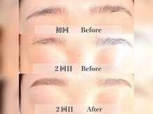 シックビューティバー(Chic Beauty Bar)/眉毛ワックス経過
