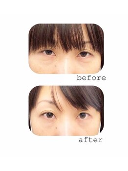 サロン ド ラヴィエール(salon de Laviere)/eyeケア集中トリートメント