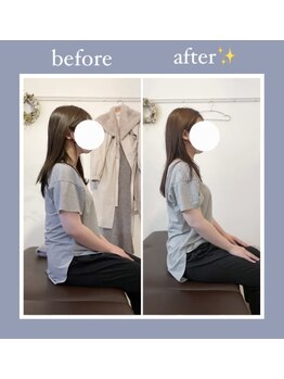 ハルノハナ鍼灸治療院/猫背改善！