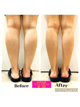 グレイティフル(Grateful)/気になる足首