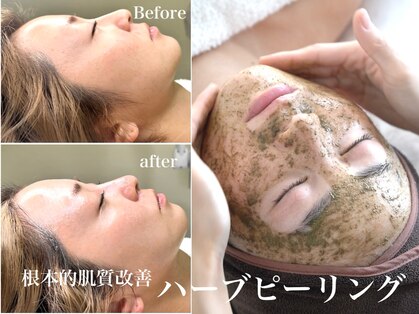 ビバディ(Vivady)の写真