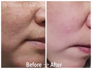 ブリリアント シェル(Brilliant Shell)/次世代スポンジアフェイシャル☆