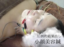 肌美鍼
