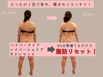 ミラ 札幌店(Mira)/背中お腹周り１回の効果