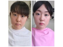 エタニティ(Eternity)