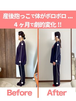 整体院ひなた 都城院/産後抱っこで肩こり腰痛が改善!!