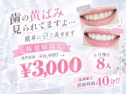 ホワイトニングショップ 守谷店(whitening shop)の写真