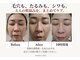 オルミラ 自由が丘(ORMIRA)の写真