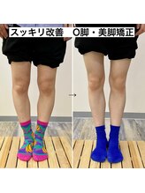 横浜DRT矯正院/弘明寺で評判のO脚・美脚矯正