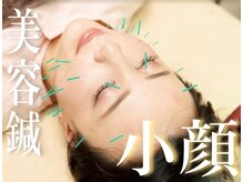 ボディラボ鍼灸整骨院(BODY LAB.鍼灸整骨院)/【美容鍼灸】究極小顔/リフトUP