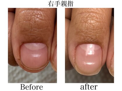 トイロ ネイル(Toiro Nail)の写真