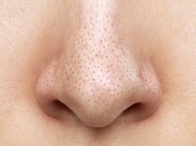 カプロ ボゥ(Capullo.Beau)/毛穴洗浄