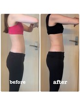 テイクオフ(Takeoff)/腰痛改善、前腿の張り軽減/O脚