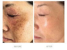 ボンクール(BONCOEUR)の雰囲気（途中経過（K様40代・施術2回/期間1ヶ月））