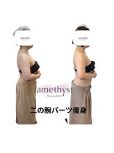 アメジスト(amethyst)/痩身×パーツサイズダウン
