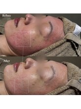 韓美(KANBI)/韓国肌管理Before After