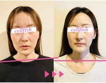 セルフィッシュ(Cellfish)