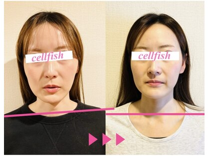 セルフィッシュ(Cellfish)の写真