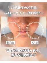 エステサロン 凛/３９歳でエステスタート！