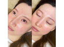 アイラッシュ ティル(eyelash till)の雰囲気（デザイン自由自在/パリジェンヌラッシュリフト/眉毛スタイリング）