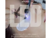 アレーズ(alaise)