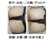 フロージア 新宿南口店(FLOGIEIA)の雰囲気（全身可能♪肌質改善のプロが施術で安心♪／ハーブピーリング専門）