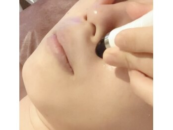 ティアエ(T-ae)/ハイドロフェイシャル 毛穴洗浄