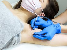 リゼクシー INTERNATIONAL麻布十番 六本木(RESEXXY)/脇脱毛