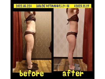ドルチェヴィータ(DOLCE VITA)/痩身モニター様1年間(ピル服用)