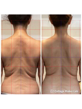 オーシャンスパ(OCEAN SPA)/リンパ×スライドカッピング