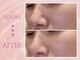 クリアラボ 上野(Clear Lab)の写真/【韓国式肌管理】[韓国式毛穴洗浄¥6000～]韓国最新美容で桁違いの透明感&水光肌に♪[毛穴レス/美肌/韓流肌]
