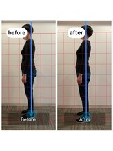 朱雀整骨院/姿勢矯正