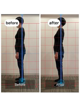 朱雀整骨院/姿勢矯正