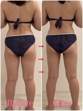 スペチアーレ 夙川/痩せにくい所に効果的