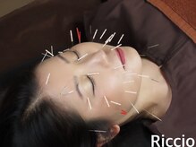 リッチョ鍼灸院(Riccio鍼灸院)