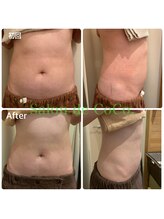 サロンドココ(Salon de CoCo.)/美腸ケアコース前後