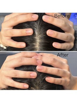 フレイヤ 恵比寿(Freyia)/【小顔矯正】