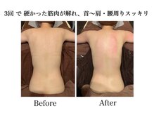 ナチュラーレ 天王寺店(Naturale)/痩身リンパマッサージ二の腕美脚